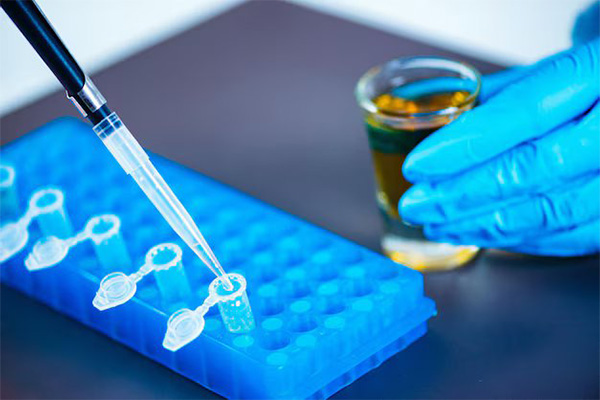 What Happens If You Think Your DNA Test Result Is Wrong